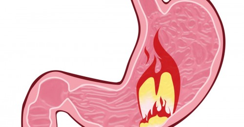 Каква храна трябва да приемате при гастрит